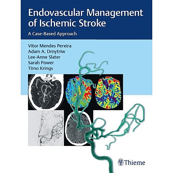 Endovascular Management of Ischemic Stroke, Vitor Mendes Pereira, Adam A. Dmytriw, Lee-Anne Slater, Sarah Power, Timo Krings