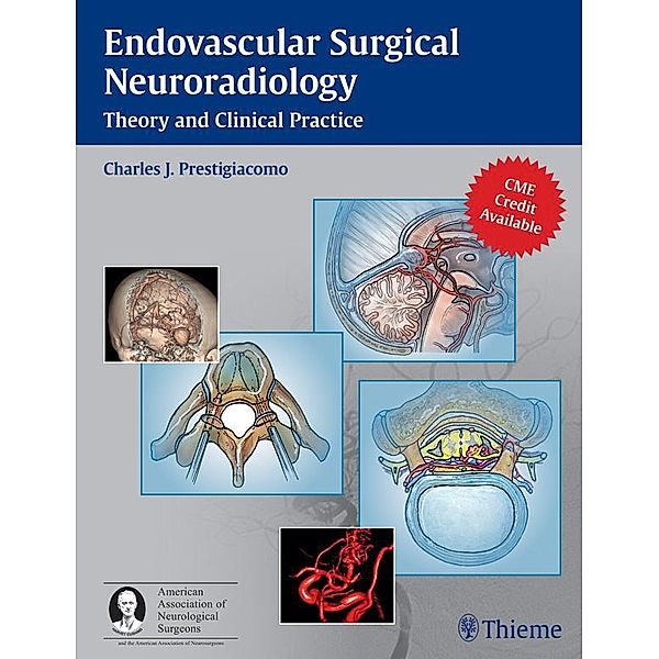 Endovascular Surgical Neuroradiology