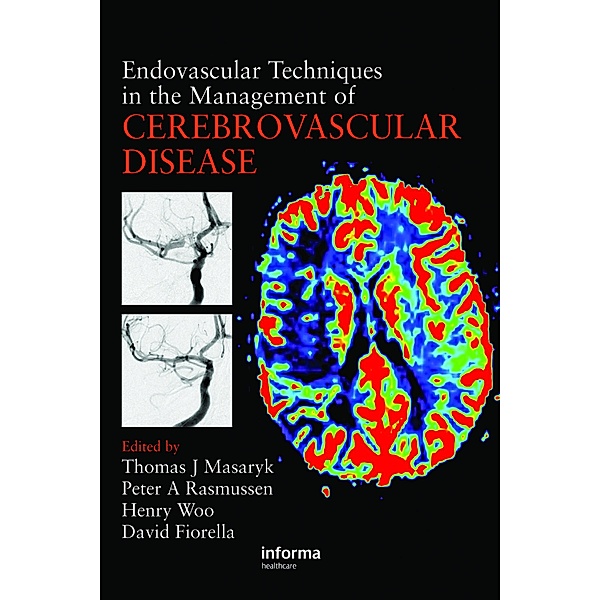 Endovascular Techniques in the Management of Cerebrovascular Disease