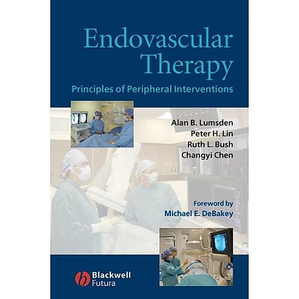Endovascular Therapy