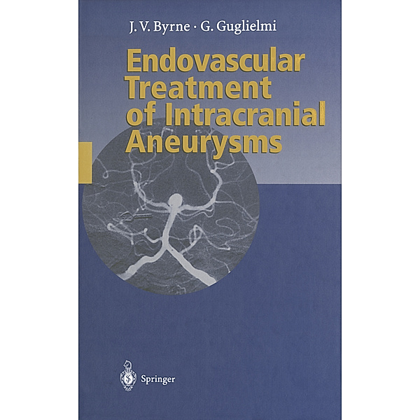 Endovascular Treatment of Intracranial Aneurysms, James Byrne, Guido Guglielmi
