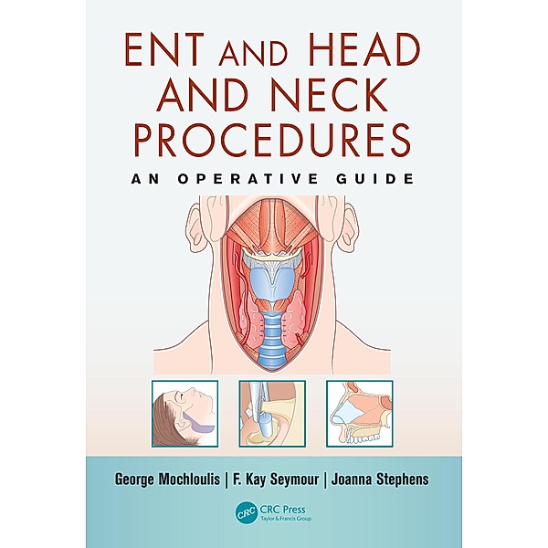 ENT and Head and Neck Procedures, George Mochloulis, F. Kay Seymour, Joanna Stephens