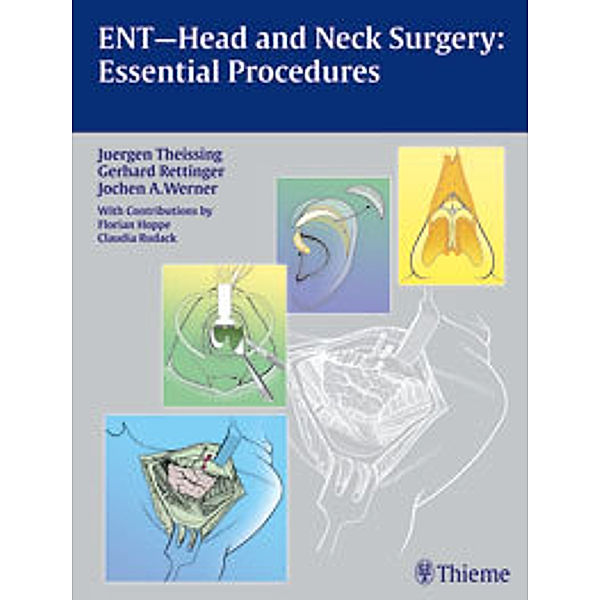 ENT-Head and Neck Surgery: Essential Procedures, Juergen Theissing, Gerhard Rettinger, Jochen A. Werner