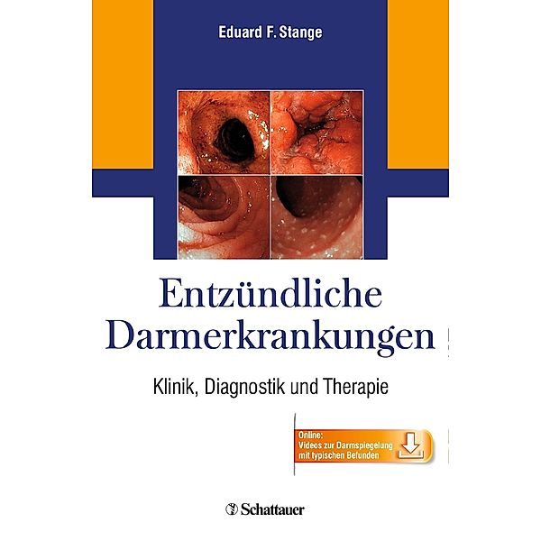 Entzündliche Darmerkrankungen