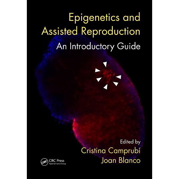 Epigenetics and Assisted Reproduction