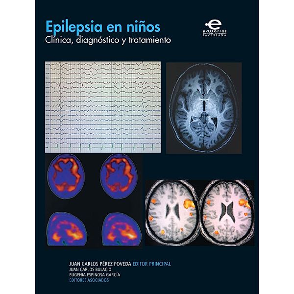 Epilepsia en niños, Varios Autores
