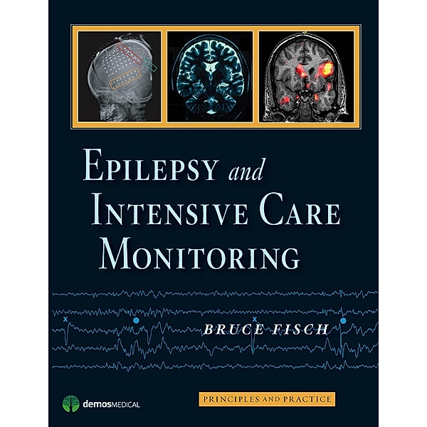 Epilepsy and Intensive Care Monitoring, Bruce J Fisch