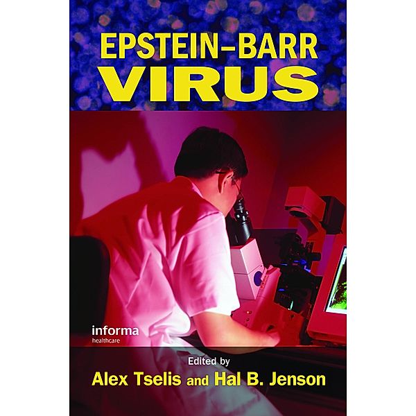 Epstein-Barr Virus