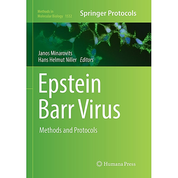 Epstein Barr Virus
