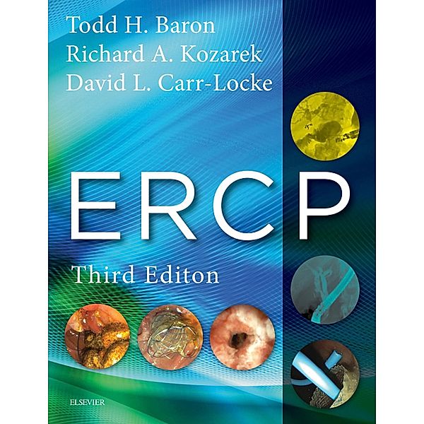 ERCP E-Book, Todd H. Baron, Richard A. Kozarek, David Leslie Carr-Locke