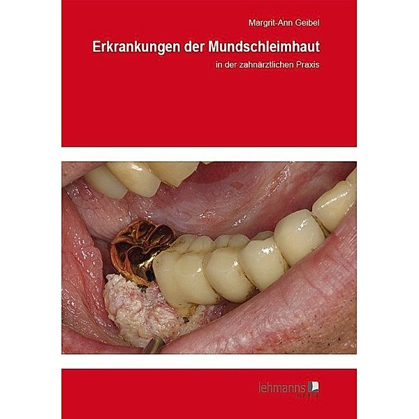 Erkrankungen der Mundschleimhaut, Margrit-Ann Geibel