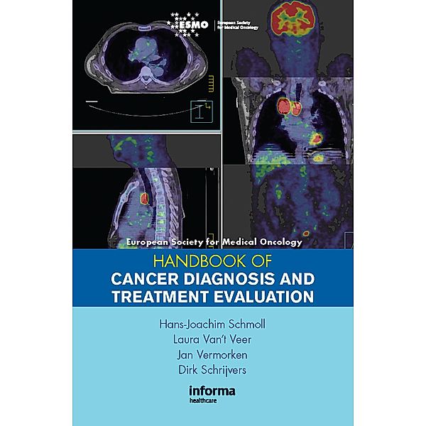 ESMO Handbook of Cancer Diagnosis and Treatment Evaluation