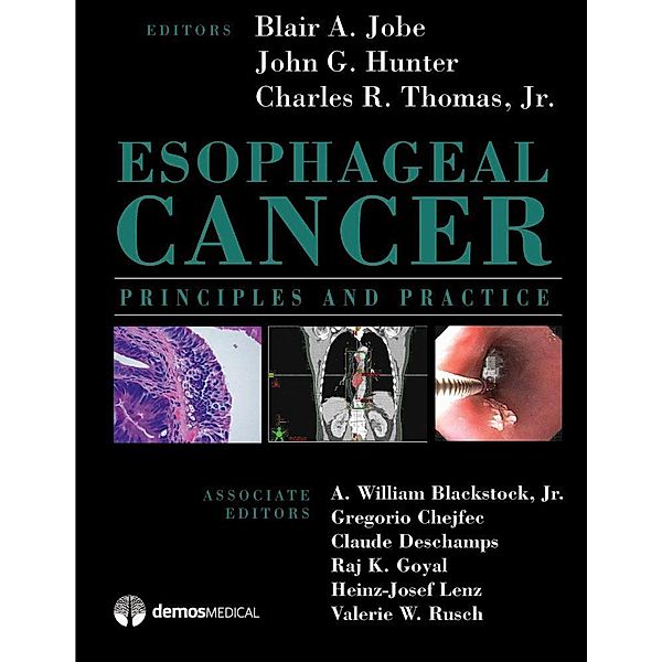 Esophageal Cancer, Thomas R. Charles, John G. Hunter, Blair A. A Jobe
