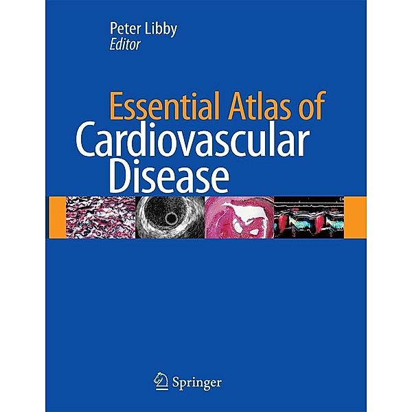 Essential Atlas of Cardiovascular Disease [With CDROM]