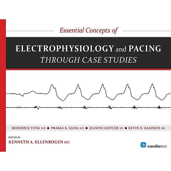 Essential Concepts of Electrophysiology and Pacing through Case Studies, Roderick Tung, Prabal Guha