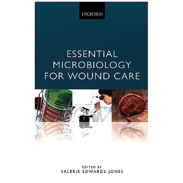 Essential Microbiology for Wound Care