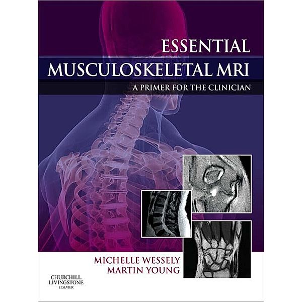 Essential Musculoskeletal MRI E-Book, Michelle Anna Wessely, Martin Ferrier Young