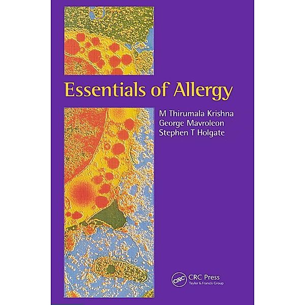 Essentials of Allergy, M Thirumala Krishna, George Mavroleon, Stephen T Holgate