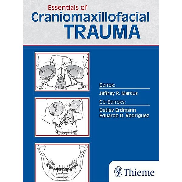 Essentials of Craniomaxillofacial Trauma