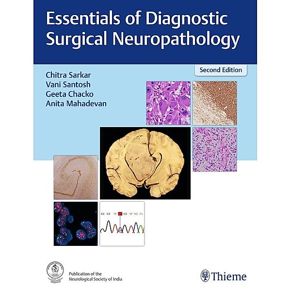 Essentials of Diagnostic Surgical Neuropathology