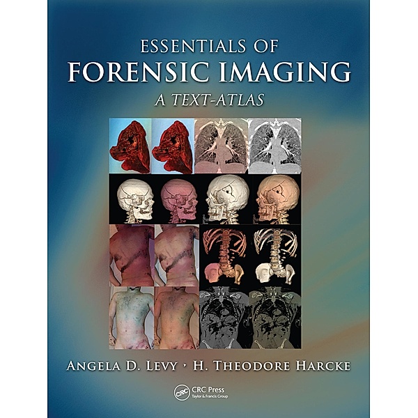 Essentials of Forensic Imaging, Angela D. Levy, H. Theodore Harcke Jr.