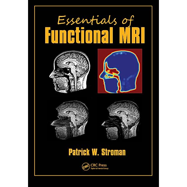 Essentials of Functional MRI, Patrick W. Stroman