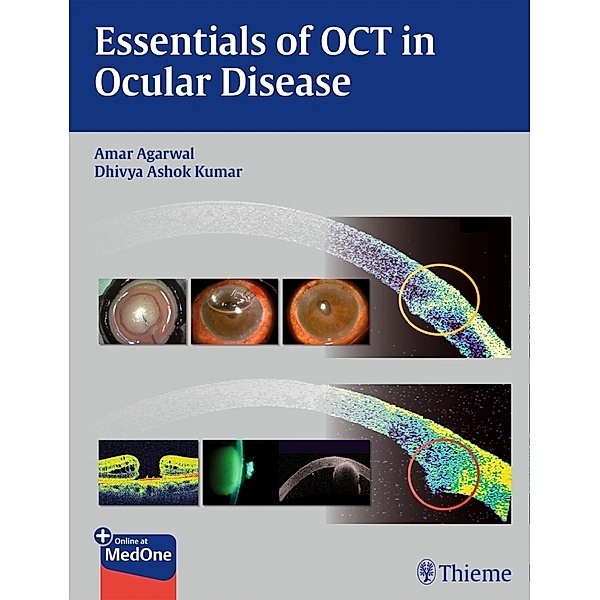 Essentials of OCT in Ocular Disease, Amar Agarwal