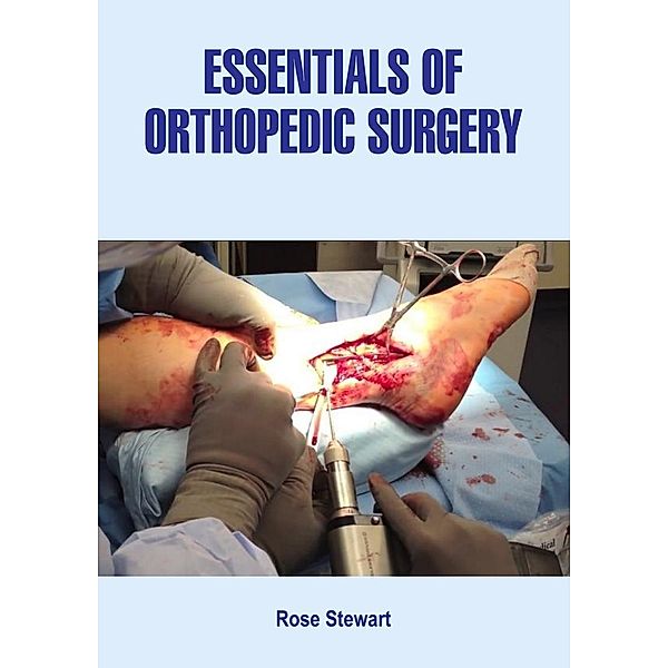 Essentials of Orthopedic Surgery, Rose Stewart
