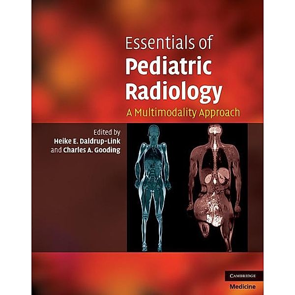 Essentials of Pediatric Radiology