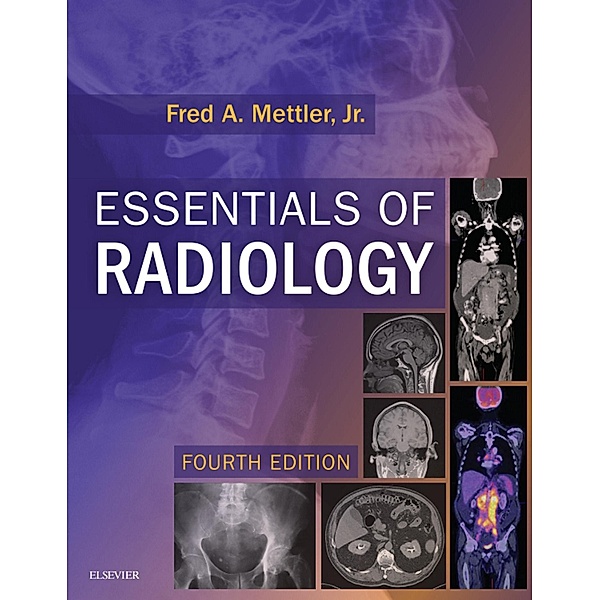 Essentials of Radiology E-Book, Fred A. Mettler