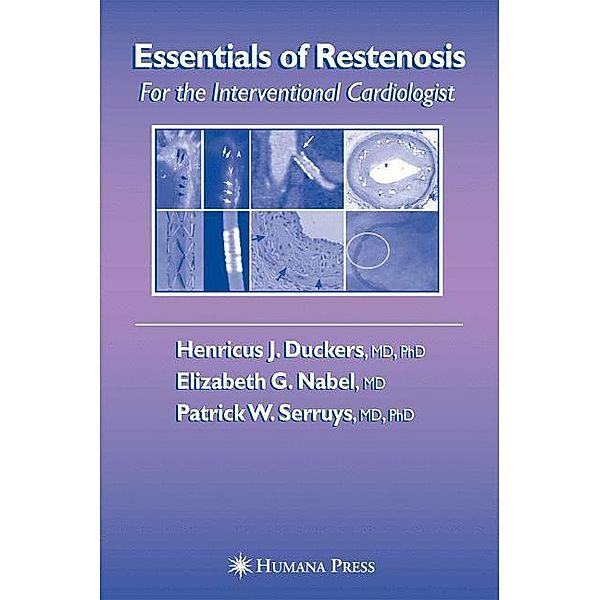Essentials of Restenosis