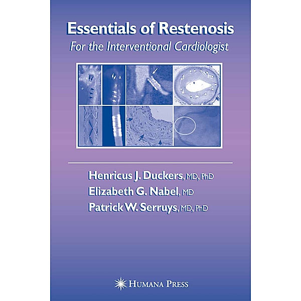 Essentials of Restenosis