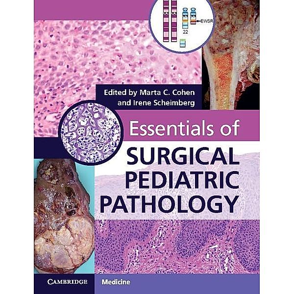 Essentials of Surgical Pediatric Pathology