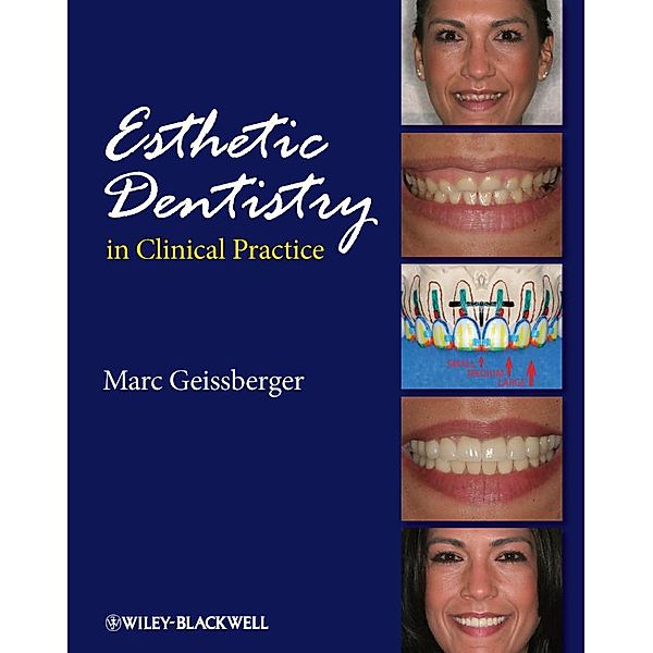 Esthetic Dentistry in Clinical Practice, Marc Geissberger