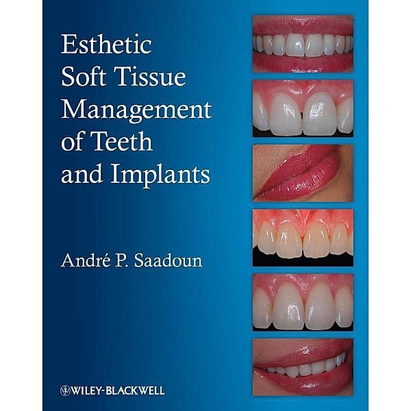 Esthetic Soft Tissue Management of Teeth and Implants, Andre P. Saadoun