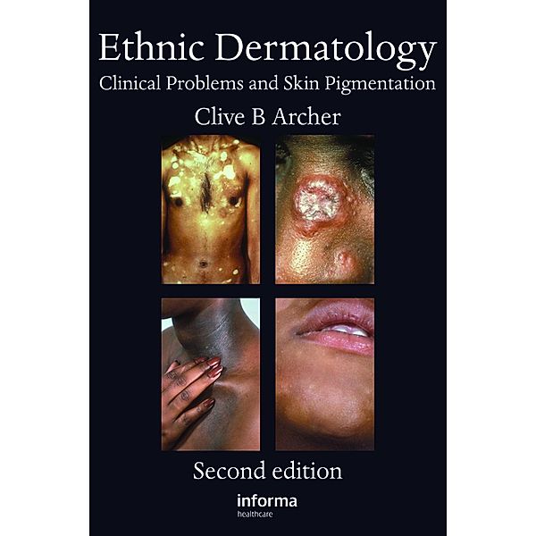 Ethnic Dermatology