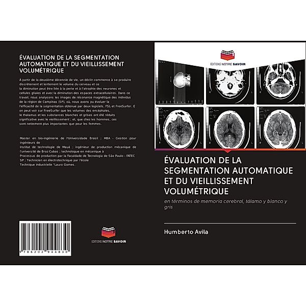 ÉVALUATION DE LA SEGMENTATION AUTOMATIQUE ET DU VIEILLISSEMENT VOLUMÉTRIQUE, Humberto Avila