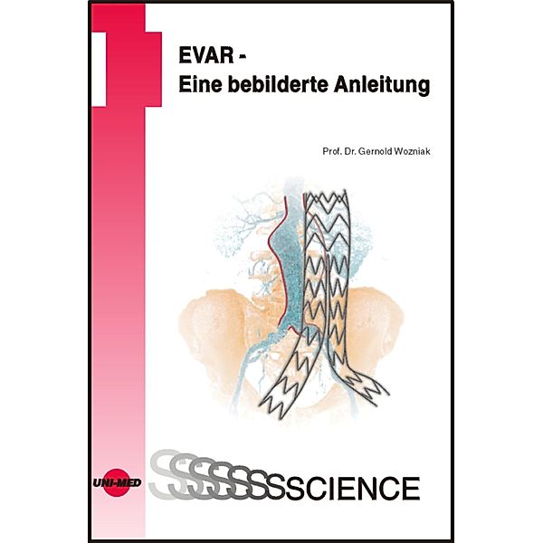 EVAR - Eine bebilderte Anleitung / UNI-MED Science, Gernold Wozniak