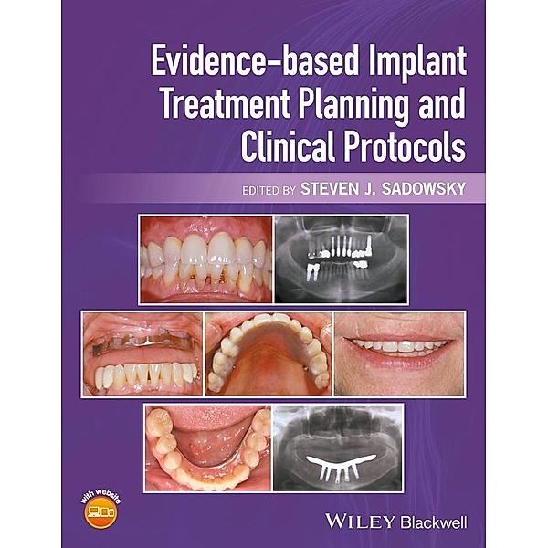 Evidence-based Implant Treatment Planning and Clinical Protocols