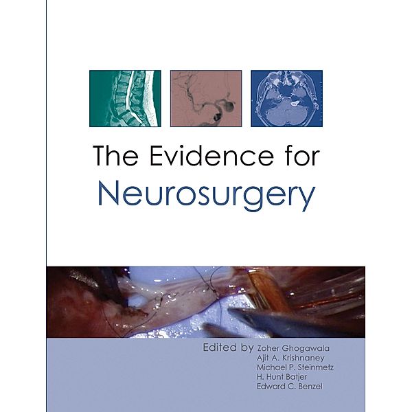 Evidence for Neurosurgery, Zoher Ghogawala