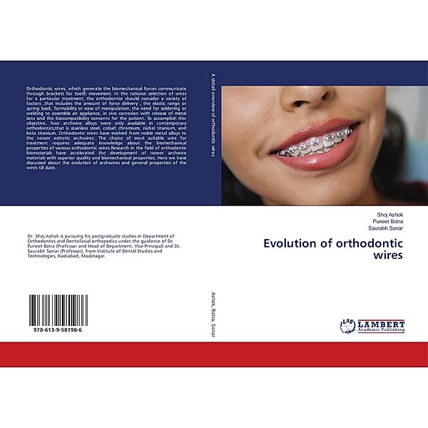 Evolution of orthodontic wires, Shoj Ashok, Puneet Batra, Saurabh Sonar