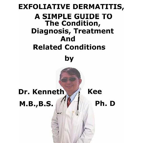 Exfoliative Dermatitis, (Erythroderma) A Simple Guide To The Condition, Diagnosis, Treatment And Related Conditions, Kenneth Kee