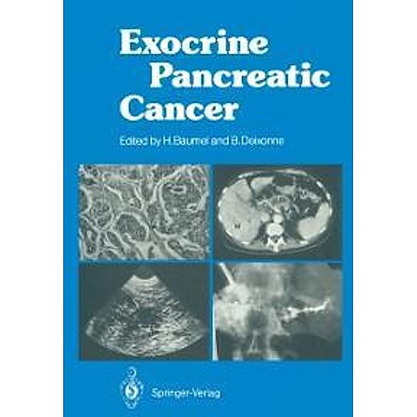 Exocrine Pancreatic Cancer