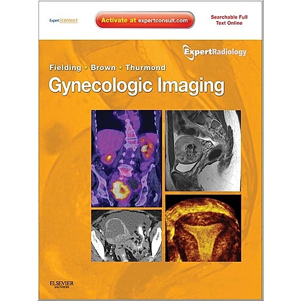 Expert Radiology: Gynecologic Imaging E-Book, Julia R. Fielding, Amy S. Thurmond, Douglas L. Brown