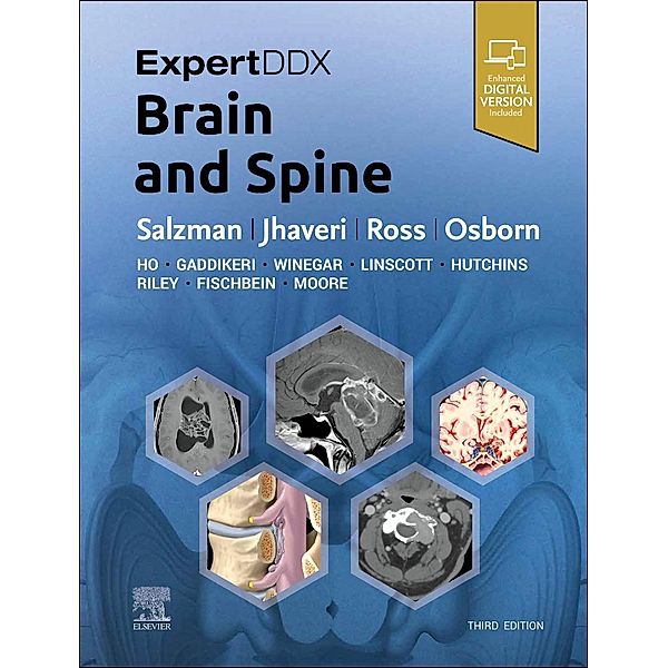 ExpertDDx: Brain and Spine, Karen L. Salzman, Miral D. Jhaveri, Jeffrey S. Ross