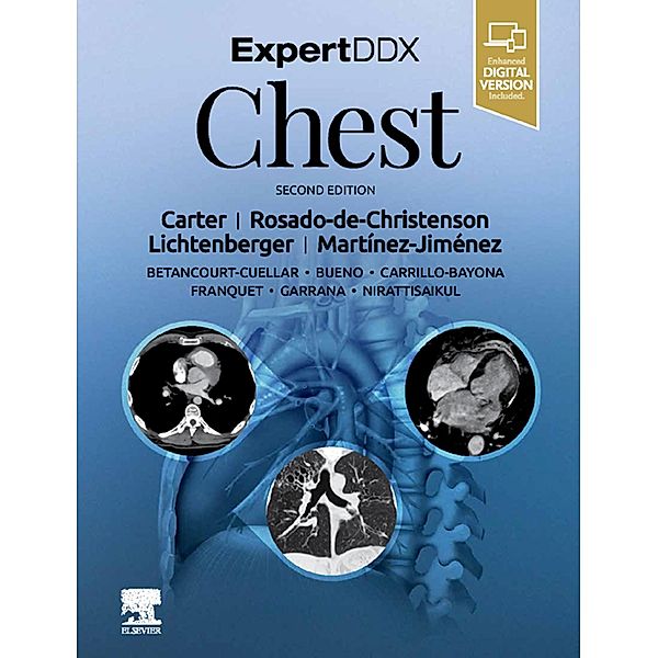 ExpertDDx: Chest, Brett W. Carter, Melissa L. Rosado-de-Christenson, Iii John P. Lichtenberger, Santiago Martínez-Jiménez