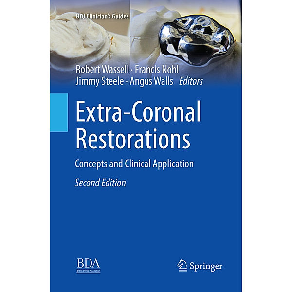 Extra-Coronal Restorations