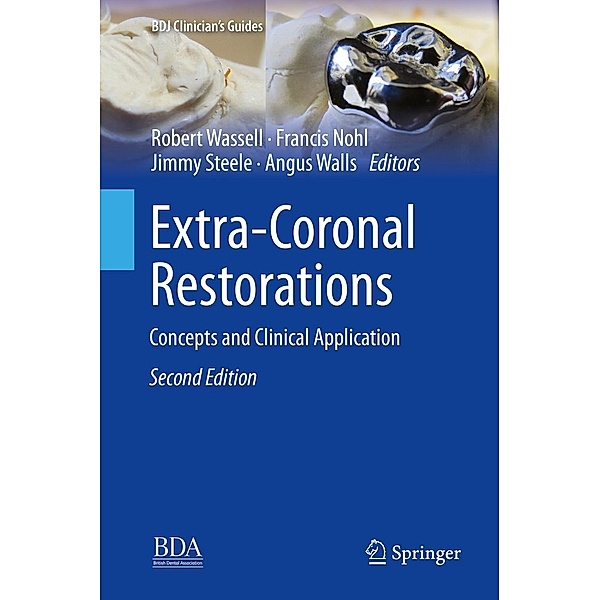Extra-Coronal Restorations / BDJ Clinician's Guides