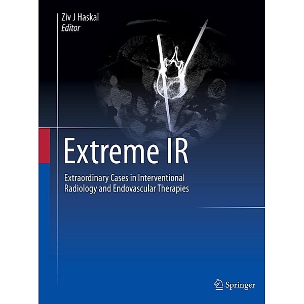 Extreme IR
