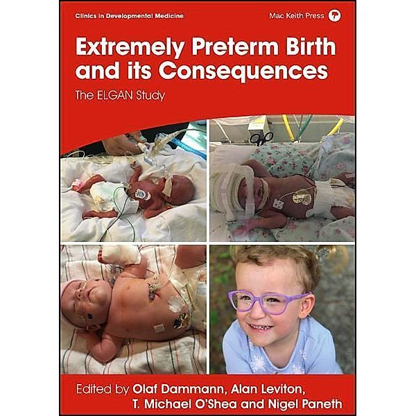 Extremely Preterm Birth and its Consequences